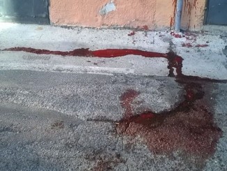 accoltellamento in via san vitale
