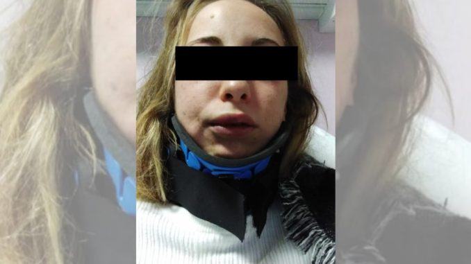 Ragazza massacrata di botte, 10 giorni di prognosi per lei, indagini 