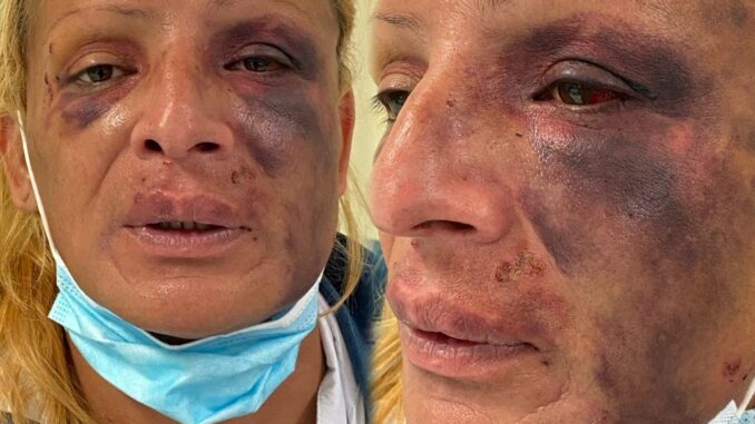 Morte di Samuele De Paoli, Avvocato Gatti: «Patrizia si è solo difesa»